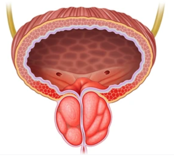 Điều trị Tăng sản lành tính tuyến tiền liệt(BPH) 2022