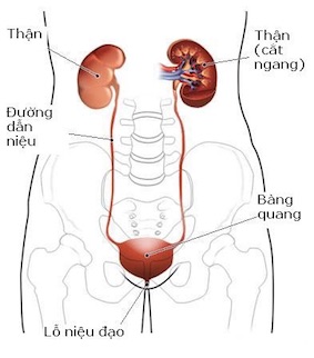 Những biến chứng tán sỏi niệu quản ngược dòng bằng Laser Holmium