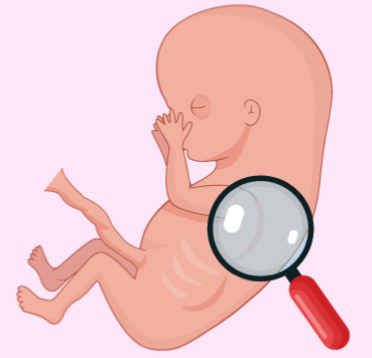 RỐI LOẠN PHÁT TRIỂN GIỚI TÍNH (DSD)