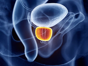 Phì đại tiền liệt tuyến lành tính